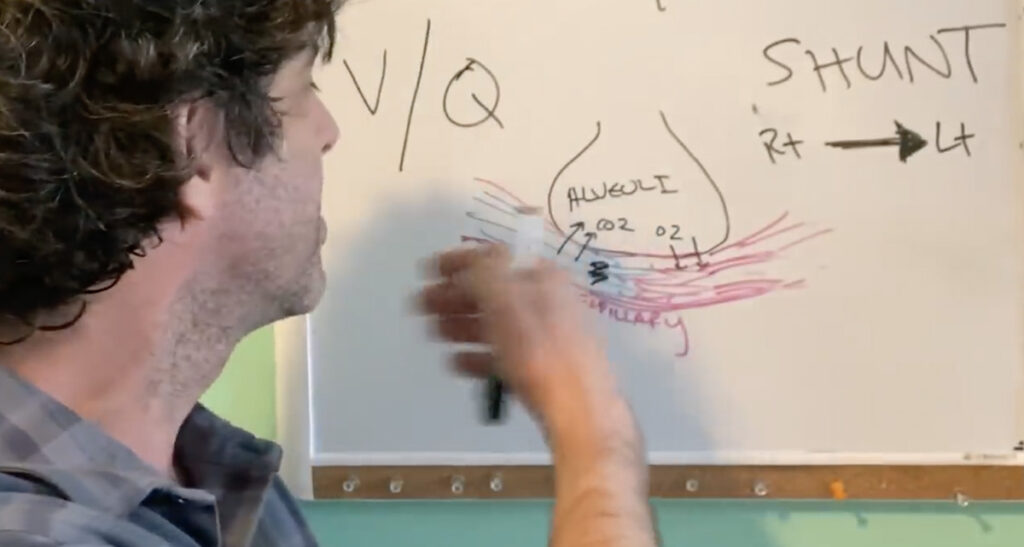 KAHTLUS: Hingamisaparaatidest on koroonaviiruse puhul rohkem kahju kui kasu