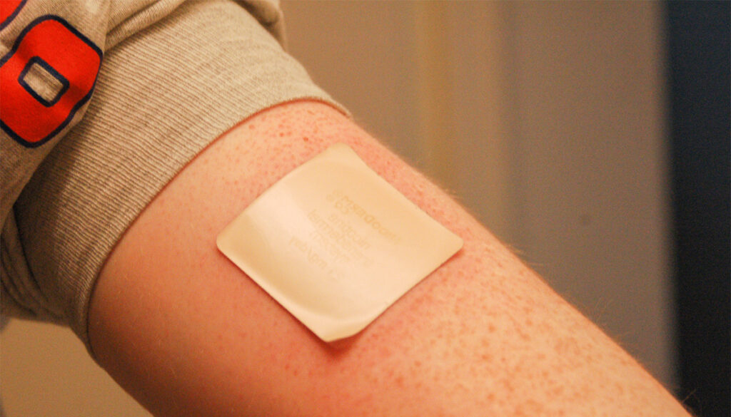 Suits ikkagi on koroonarohi? Prantsusmaal plaanitakse anda koroonapatsientidele ja meedikutele nikotiiniplaastreid pärast seda, kui selgus, et suitsetajatel esineb vähem koroonaviirust