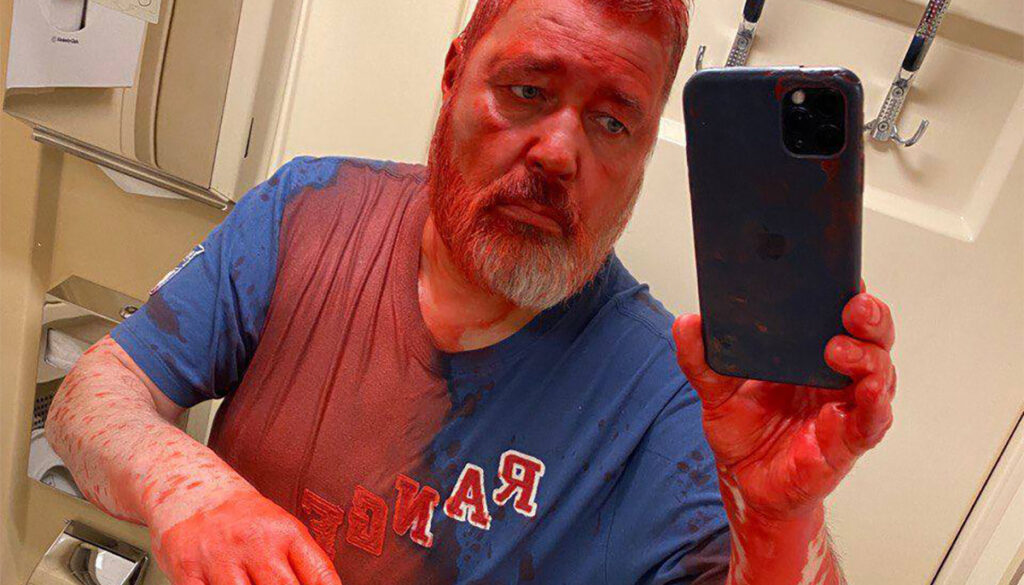 PILTUUDIS: Nobeli preemia laureaat visati Venemaal värviga üle