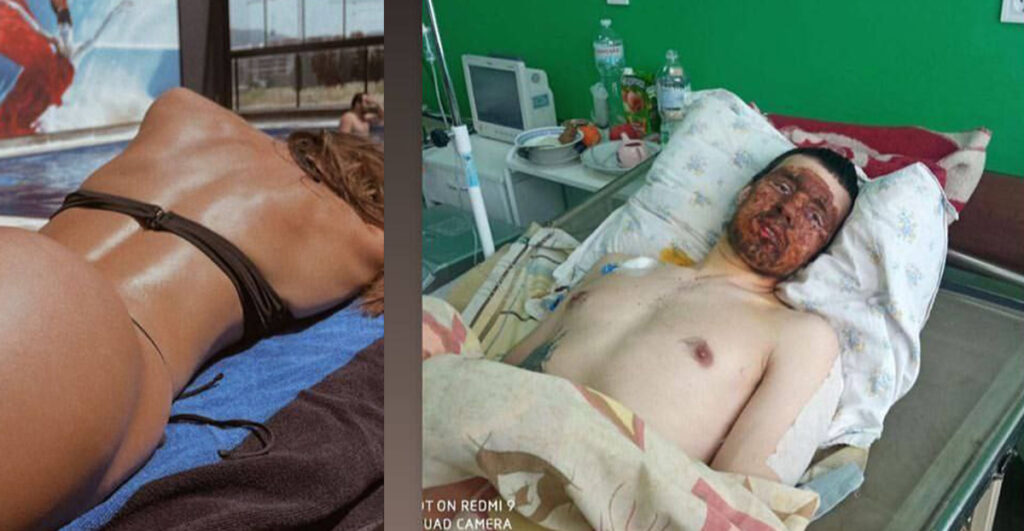 Praeguse sõja omapära: mehed lamavad haiglas, naised plaažil