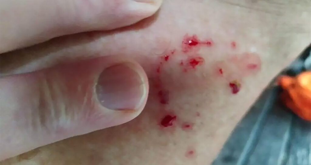 Soomes pures naist haug