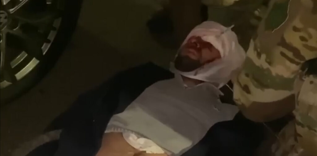 VIDEO: Ukraina presidendiga seotud autoõnnetuses sai raskelt vigastada üks autojuht (NB! Nõrganärvilistele mittesoovitav)