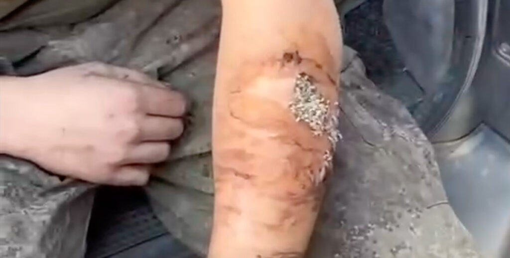 VIDEO: Ukrainas hakkasid vaglad Vene sõduri käsivart sööma NB! Nõrganärvilistele mittesoovitav