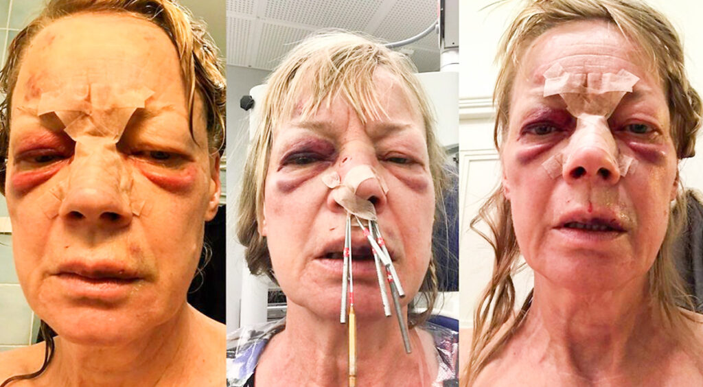 Viis noorukit peksid Helsingis naise vaeseomaks – olid veel naernud selle peale