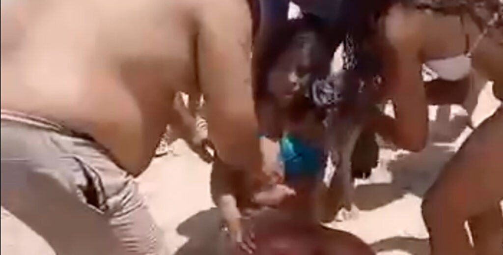 VIDEO: hai hammustas tüdrukul käe otsast (NB! Nõrganärvilistele mittesoovitav)