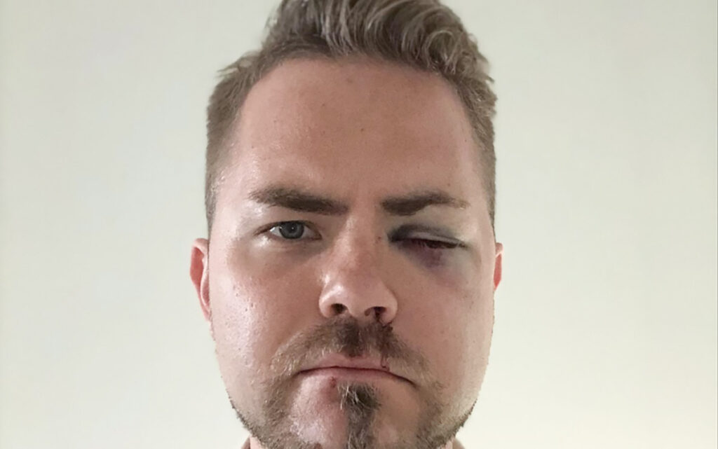 Tallinna Pride’i käigus noamehe rünnaku ohvriks langenud Soome pastor pani pildi veebi üles