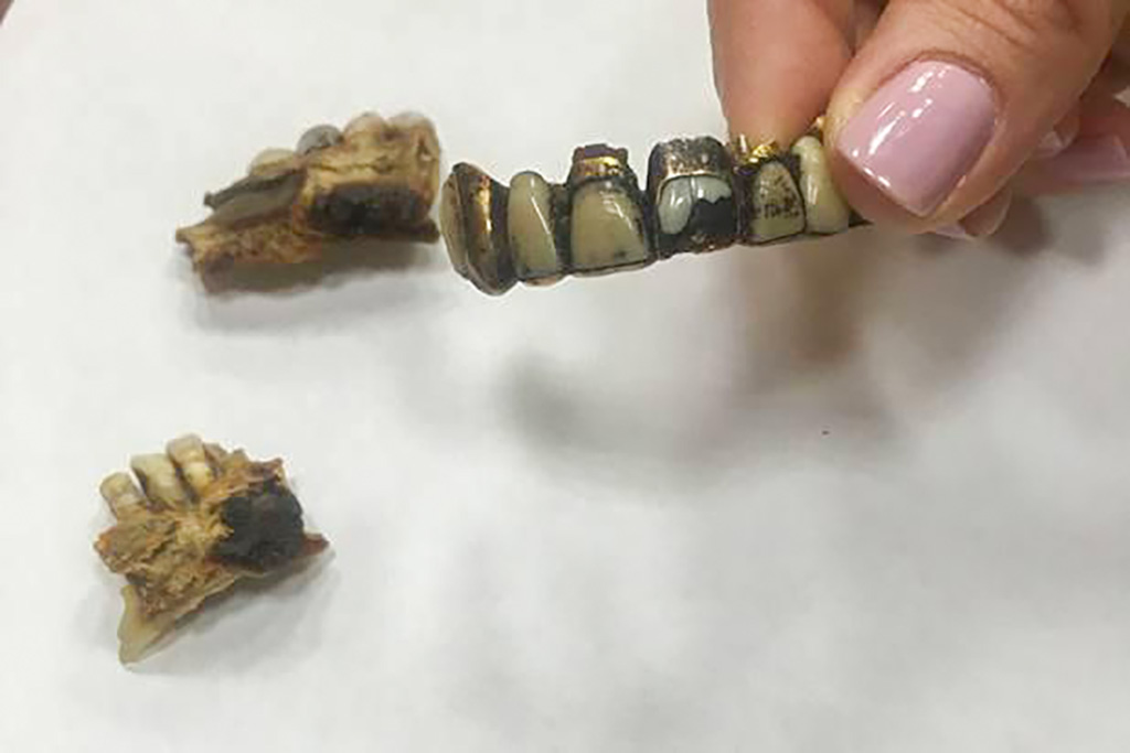 Venemaal toodi esimest korda välja Hitleri hambad