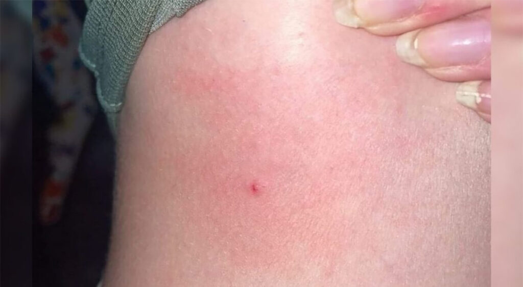 Prantsuse muusikaüritusel torgiti nõeltega 145 inimest