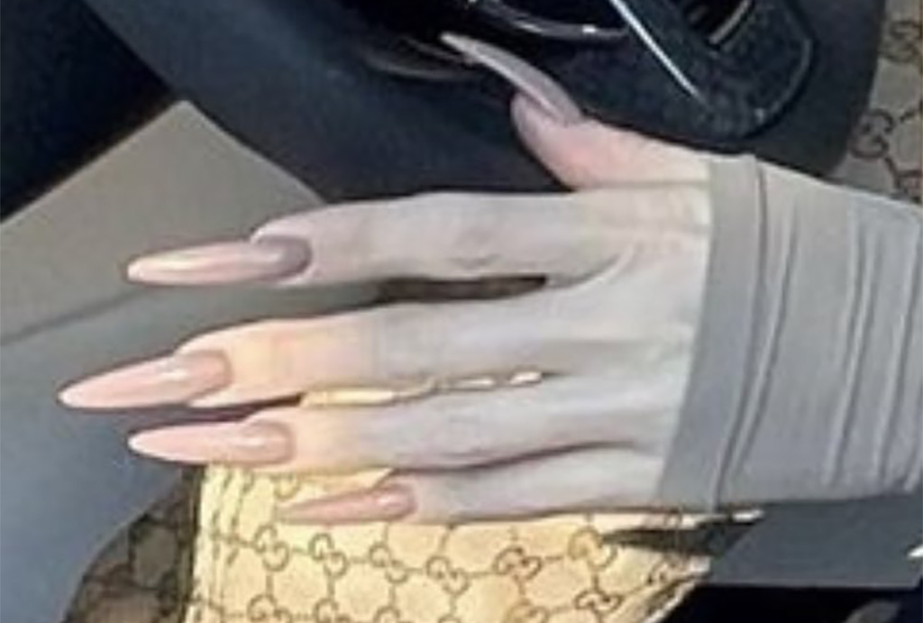 Jahmatav avastus: kaalulangetusravimite kõrvalnäht on nn vampiiri käed