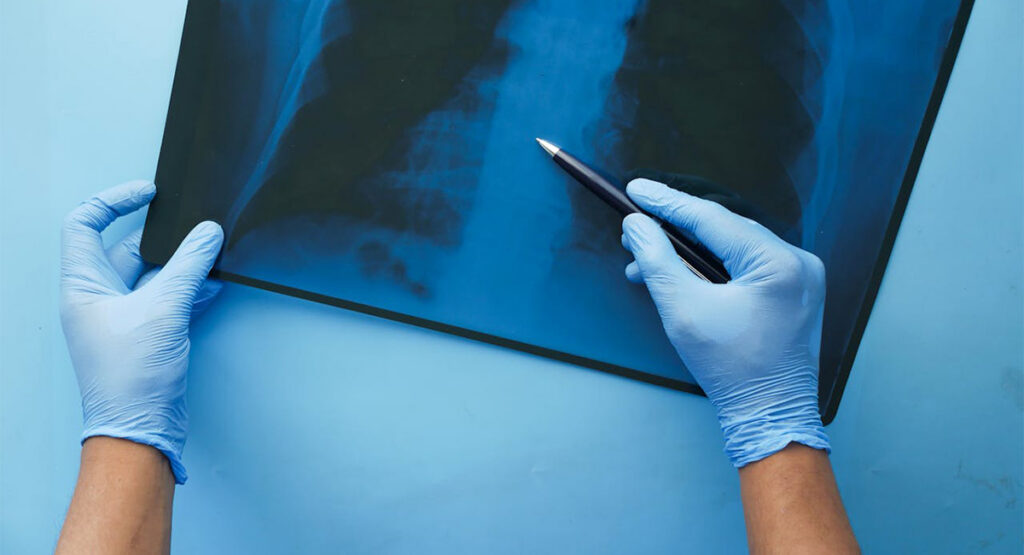 Vana hirmus haigus on taas Soome jõudnud