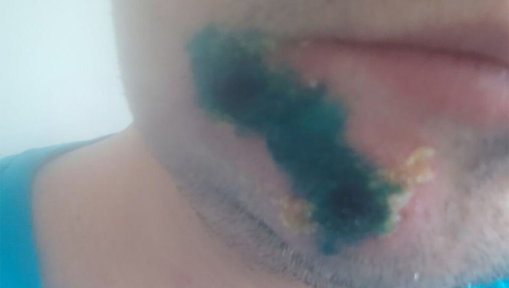 Ohtlik viirus on jõudnud Soome lähedale