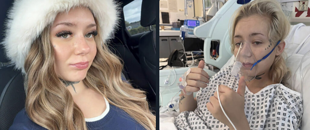 Inglise tüdruk sai veipimisest 21-aastaselt 3. astme vähi