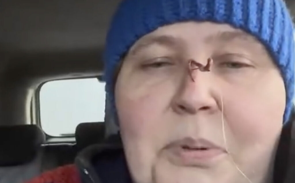 VIDEO: poeg püüdis ema õngega kinni NB! Nõrganärvilistele mittesoovitav